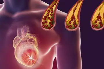 10+ Foods that You Should Eat Daily for Clean Arteries
