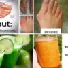 Doctor Confirmed: Say Goodbye to Arthritis with this Ultimate Remedy