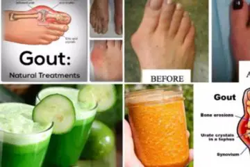 Doctor Confirmed: Say Goodbye to Arthritis with this Ultimate Remedy