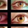 7 Health Warnings Your Eyes May Be Sending