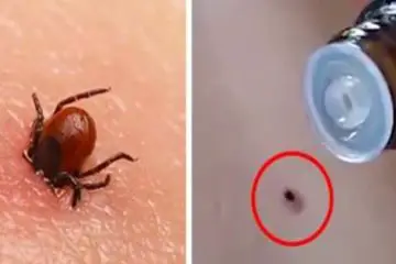 Experts Warn that this Viral Video of a Woman Getting Rid of a Tick with Peppermint Oil Is Highly Dangerous