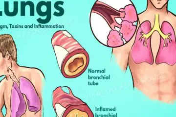 How to Get Rid of Phlegm & Mucus in the Chest & Throat