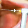 Toxic Teeth: How Root Canal Procedure Increases the Risk of Chronic Disease