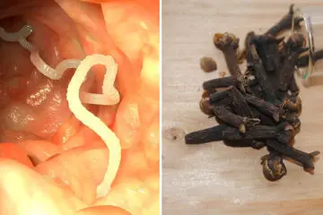 10 Warning Signs Your Body Is Full of Parasites + 7 Foods to Kill Them