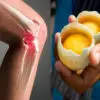 The most Effective Method to Use 2 Eggs to Treat Knee Pain & Repair the Joints