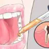 Natural Toothache Remedies that Your Dentists Does not Want You to Know