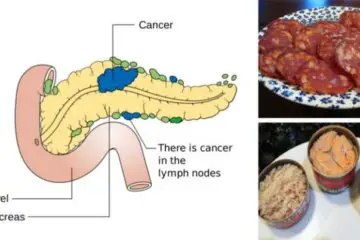 10 Foods Linked with Cancer You Should Never Eat Again
