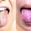Your Tongue Is Trying to Reveal these 3 Things about Your Health: Pay Attention