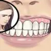 How to Recognize & Treat Toxic Tooth Infection before Heading to the Dentist’s