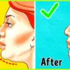 How to Get Rid of Double Chin: 5 Amazing Remedies