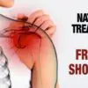 Frozen Shoulder: Natural Treatment to Heal it within Days