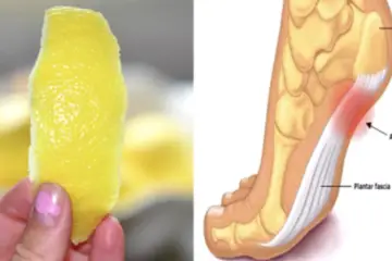 Did You Know? Lemon Peels May Eliminate Joint Ache for Good