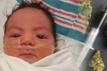For the First Time ever: Cannabis Oil Used in the Hospital to Save a 2-Month Baby
