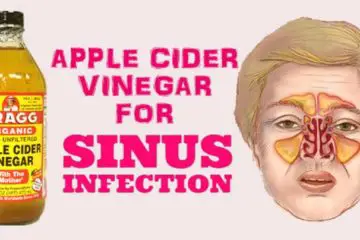 How to Use Apple Cider Vinegar & Destroy Sinus Infections within Minutes