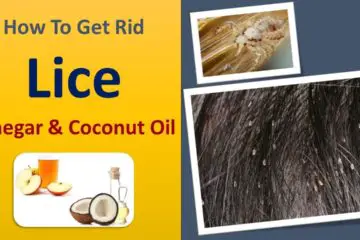 Your Child Has Lice? Use this all-Natural Potent Remedy to Destroy them fast