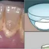 DIY Mouthwash: Remove All Plaque from Teeth in 2 Minutes