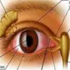 “Throw Out” the Glasses & Enhance Your Eyesight: Filatov’s Powerful Vitamin “Bomb” Remedy