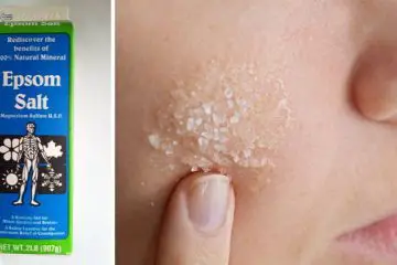8 Common Health Issues You can Treat with 2 tbsp of Epsom Salt