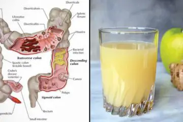 Lemon, Apple & Ginger Combo to Flush Out Pounds of Toxins