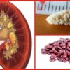 Best Natural Remedies to Ease the Removal of Kidney Stones