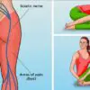 6 Simple Yoga Poses For Sciatica Pain Relief