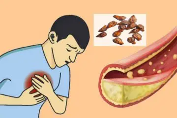 Avert Heart Attacks & Strokes & Clean Your Blood Vessels with Grape Seeds