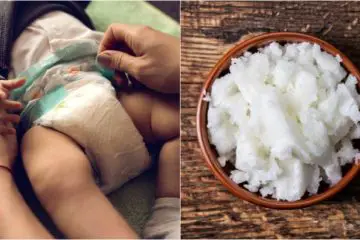 10 All-Natural & Easy Ways to Soothe Diaper Rash