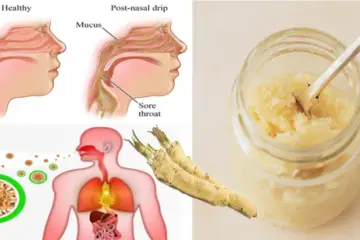 Make this Horseradish Remedy & Remove Phlegm & Mucus from the Lungs