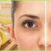 Remove Freckles & Brown Spots with this Amazing DIY All-Natural Remedy