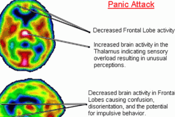 Important Discovery: Panic Attacks & Anxiety Linked to Vitamin & Iron Deficiency