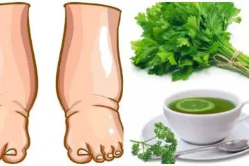 Your Legs Are Swollen? Drink this Potent DIY Tea to Cure Them