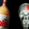 Drinks that Contain Artificial Sweeteners like Aspartame Triple the Risk of Dementia & Strokes, Study Found