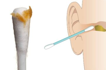 Ear Specialist Warn Us: 5 Reasons Why We Need to Stop Using Cotton Buds