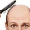 If You Want to Stop Hair Loss, Try these Effective Natural Remedies