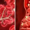 10 Useful Tips to Help Avert Blood Clots & Preserve Your Health