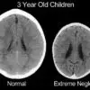 Brain Scan Shows the Terrible Damage on Kids Who’re Emotionally Abused