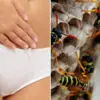 Doctors Warn: Women Need to Stop Putting Wasp Nests in their Vaginas