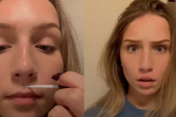 Parents, Watch Out: Teens Are Now Gluing their Lips to Make them Appear Fuller?!