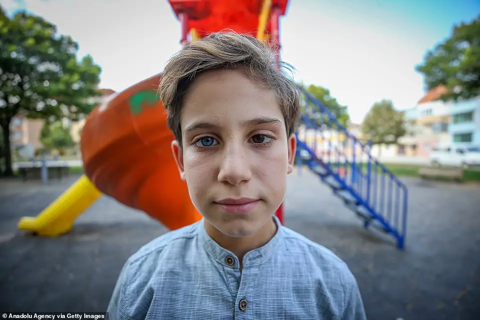 Brothers Born with Differently Coloured Eyes: Each One Has One Blue ...