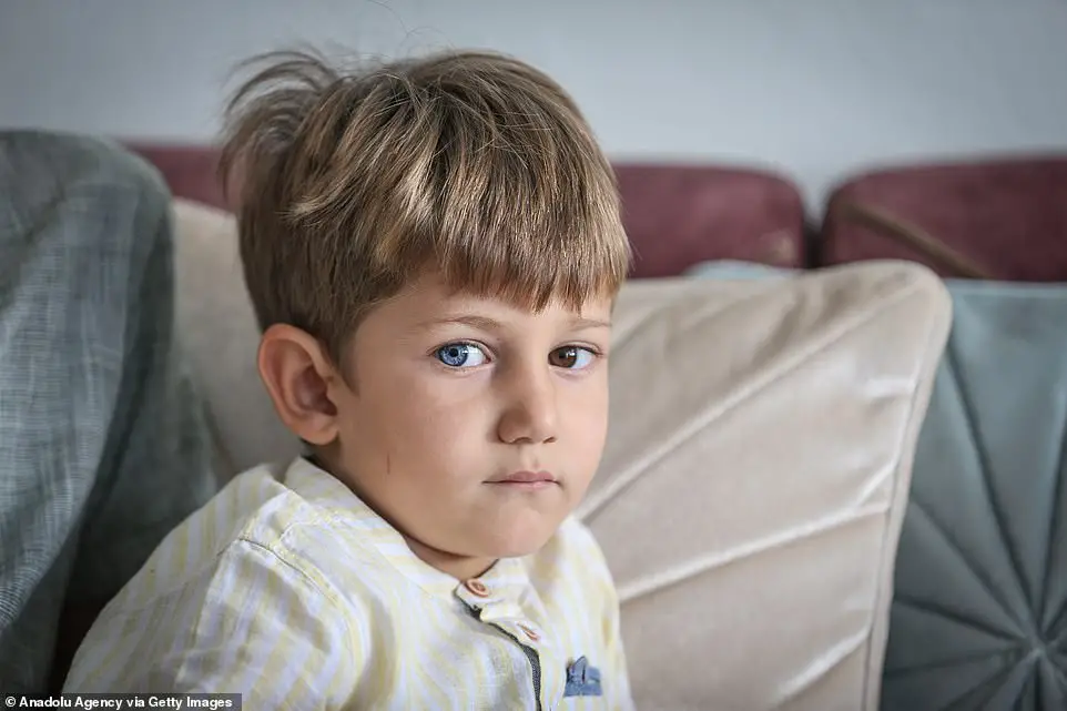 Brothers Born With Differently Coloured Eyes Each One Has One Blue And One Brown Eye