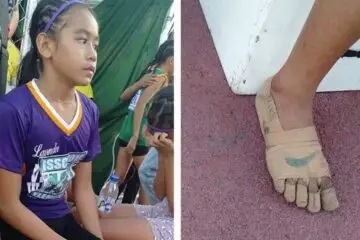 11-Year-Old Girl Wins Gold Medals Wearing ‘Shoes’ Made from Bandages