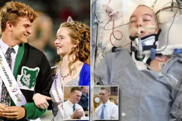 This Young Girl, 2 Years after Being Shot in the Head, Walked Proudly as the Homecoming Queen