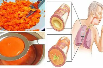 Thanks to this Ancient DIY Syrup, You can Remove Lung Phlegm & Relieve Coughing Fast