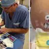 Surgeon Surprises Kids with Hand-Drawn Dressings of their Scars so that They Won’t Be the Last Memory of the Surgery