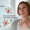 Great Natural Remedies to Alleviate Hashimoto’s Thyroiditis