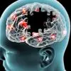 Innovative & Promising Method for Treatment of Alzheimer’s Developed by Researchers