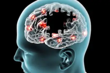 Innovative & Promising Method for Treatment of Alzheimer’s Developed by Researchers