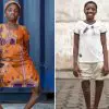 Teen with Severe Case of Bow Leg Returns to School Thanks to a Free Surgery