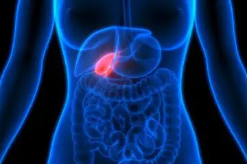 The Most Frequent Symptoms of a Gallbladder Problem (It’s Best NOT to Avoid Them)