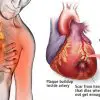 80% of Heart Attacks Could Be Avoided by Doing These 5 Easy Things